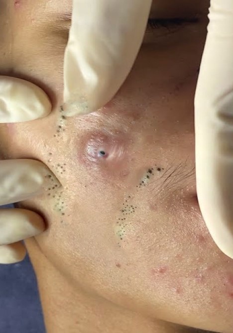 The Night Comes for Us